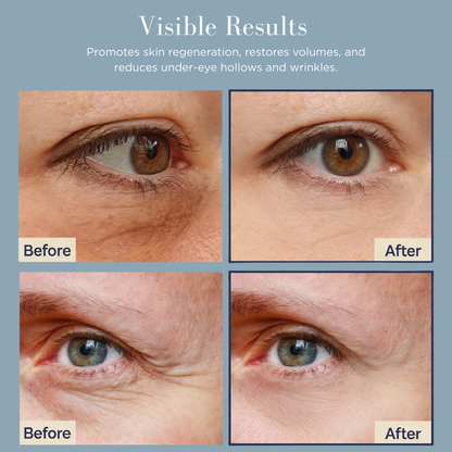 Wrinkle Eliminating Wand