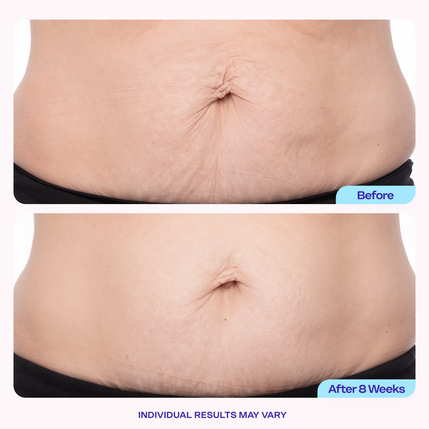 Tightening & Smoothing Belly Firming Serum