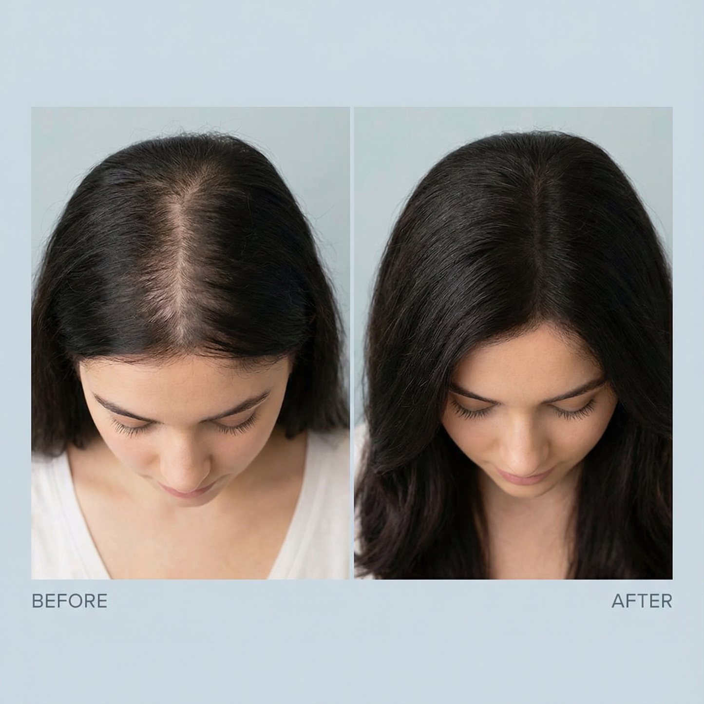 Hair Growth Activator Roll-On