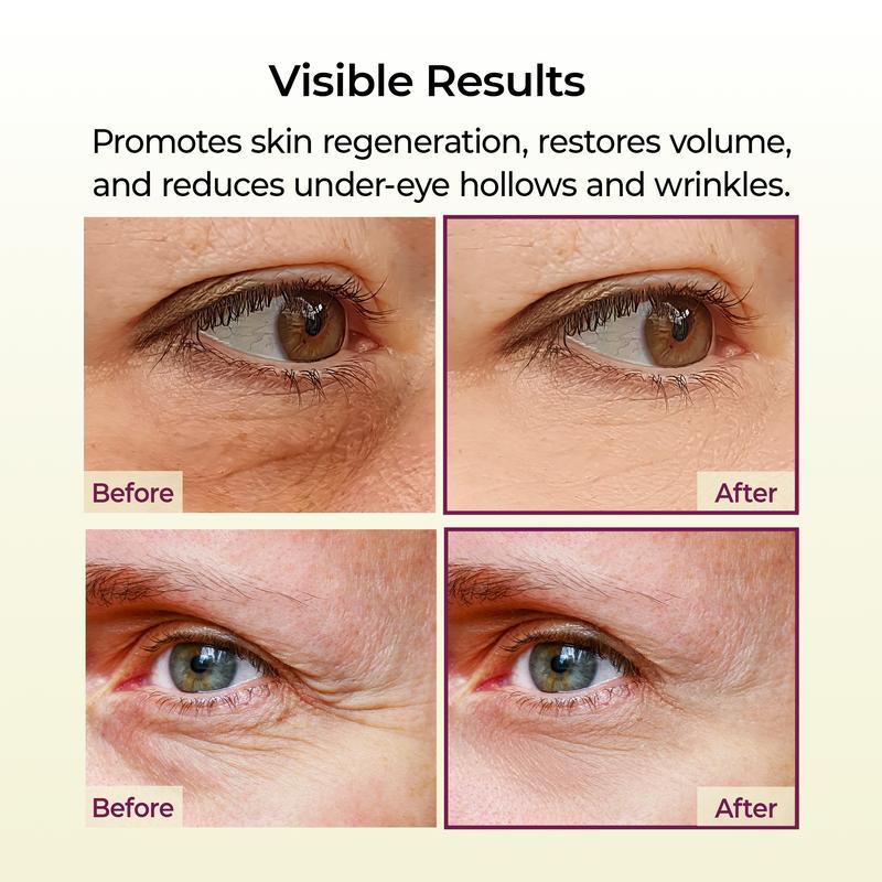 Wrinkle Elimination Skin Bundle (Wand + Patches)