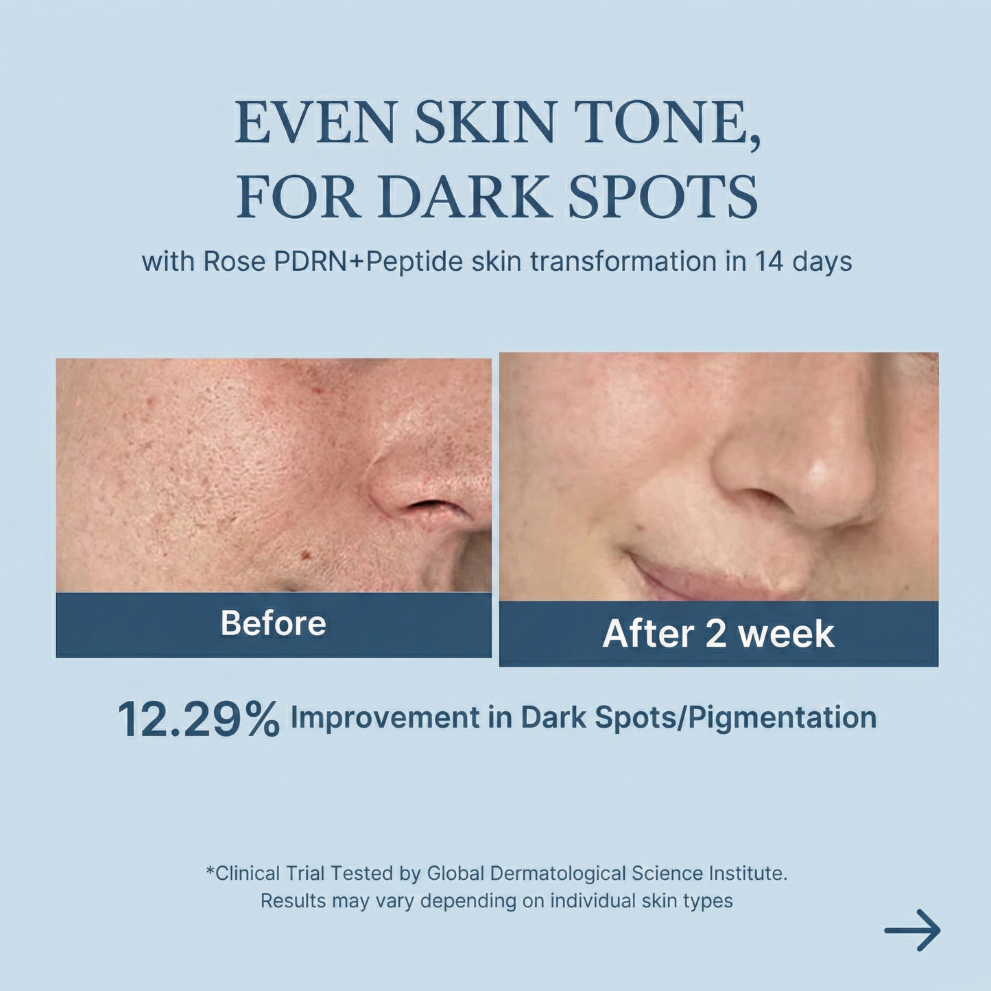 PDRN Pink Peptide Toner