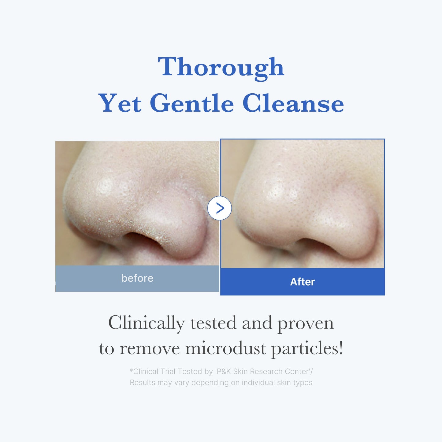 Zero Pore Cleansing Foam